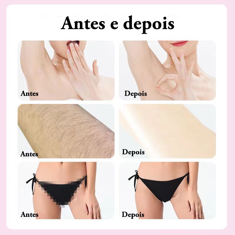 Depilador Facial Elétrico Portátil e Recarregável em Formato de Batom Indolor para Remoção de Pelos — imagem 2 de 2