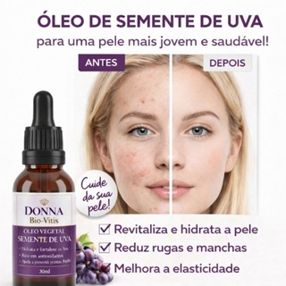 Óleo de Semente de Uva Bio-Vitis Donna | Antioxidante, Antienvelhecimento, Pele & Cabelo em Oferta na Shopee