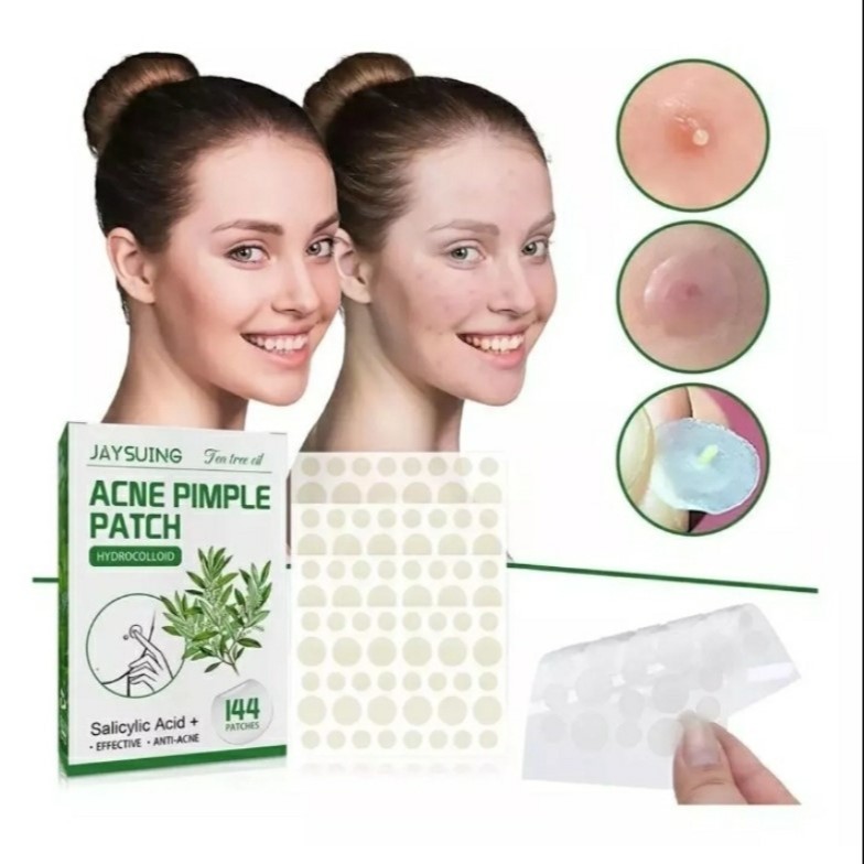 Adesivos para Acnes e Espinhas  144 Unidades Hidrocoloide Efeito Rápido e Eficaz