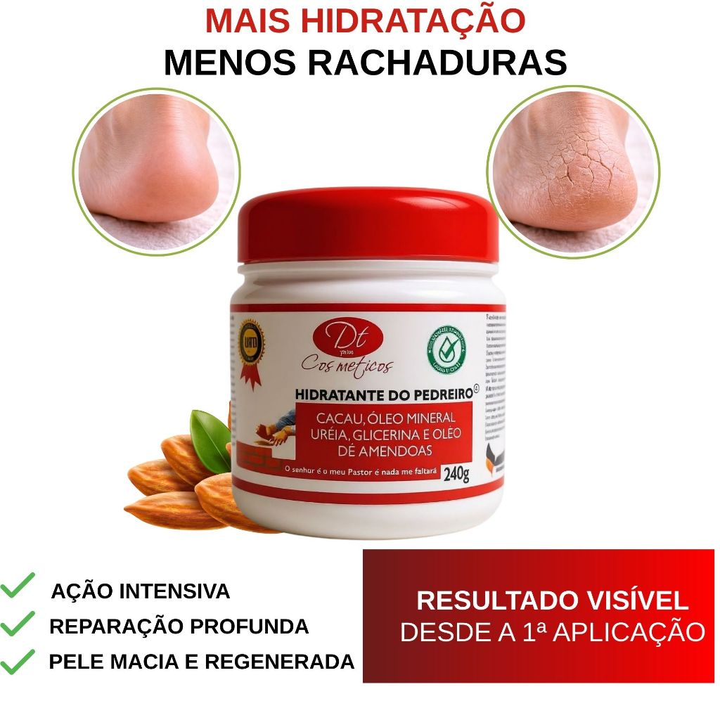 Creme Hidratante do Pedreiro Com Ureia  Para Pés Mãos Cotovelos Rachados Ressecados Hidratação Profunda Varios Tamanhos