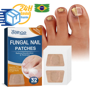 Kit Adesivo Reparador de Unhas dos Pés Cinza Fungo Unha Espessa Correção de Unhas das Mãos Infecção Paroníquia em Oferta na Shopee