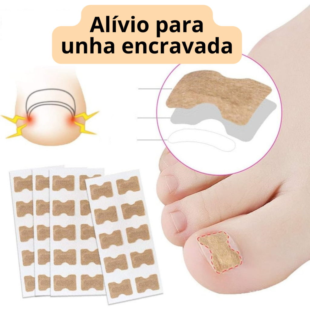Kit 20/30/50/60 Adesivo Órtose Correção de Unhas Encravadas Manicure Pedicure em Oferta na Shopee