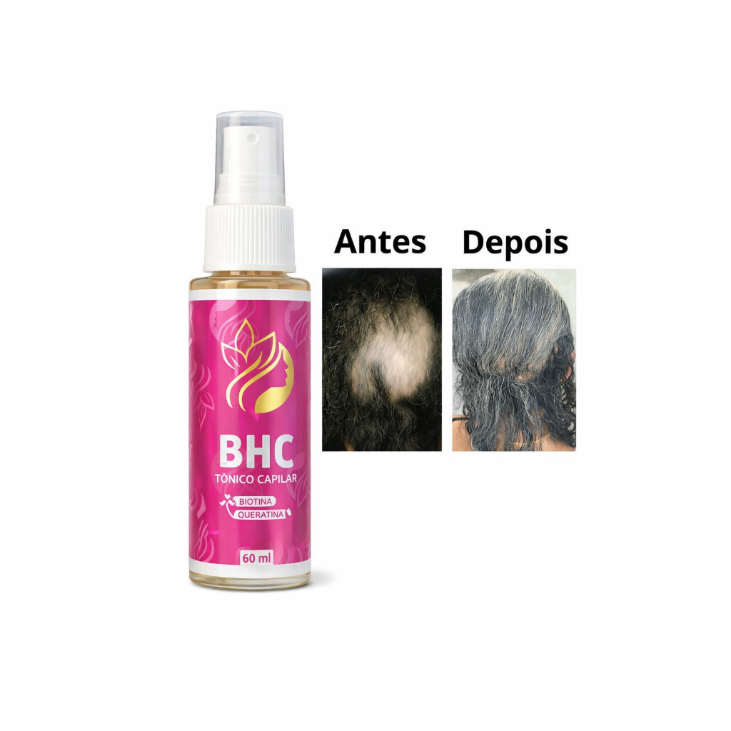 TONICO PARA O CRESCIMENTO CAPILAR E FIM DA QUEDA CAPILAR