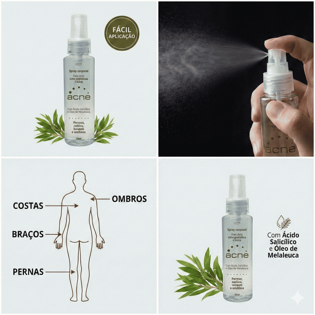 Spray Corporal Acne Melaleuca Ácido Salicílico Controle de Oleosidade Secativo Costas e Ombros 100ml