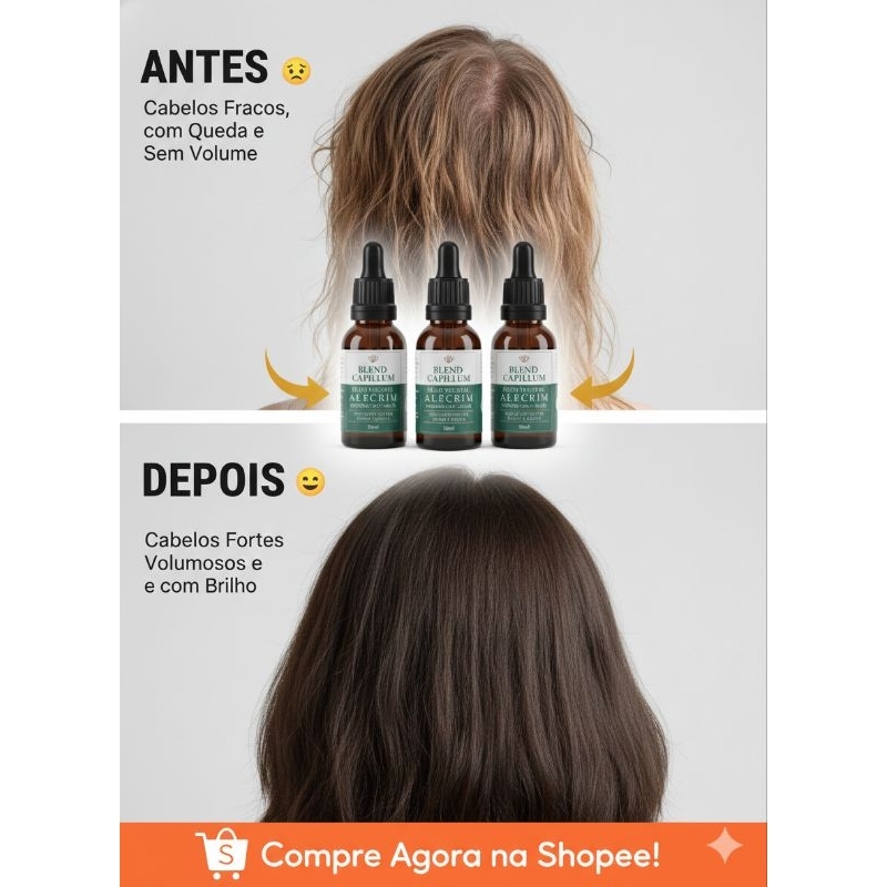 Detalhes do Óleo Alecrim 30ml Crescimento Capilar Acelerado Anticaspa Antiqueda 100% Natural Fortalecimento