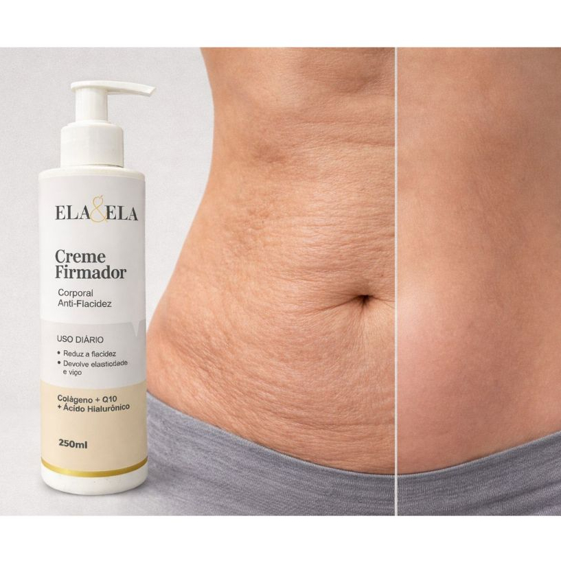 Ela&Ela creme Anti Flacidez 250 ml, com Colageno Q10 e Hialuronico diga adeus a Flacidez