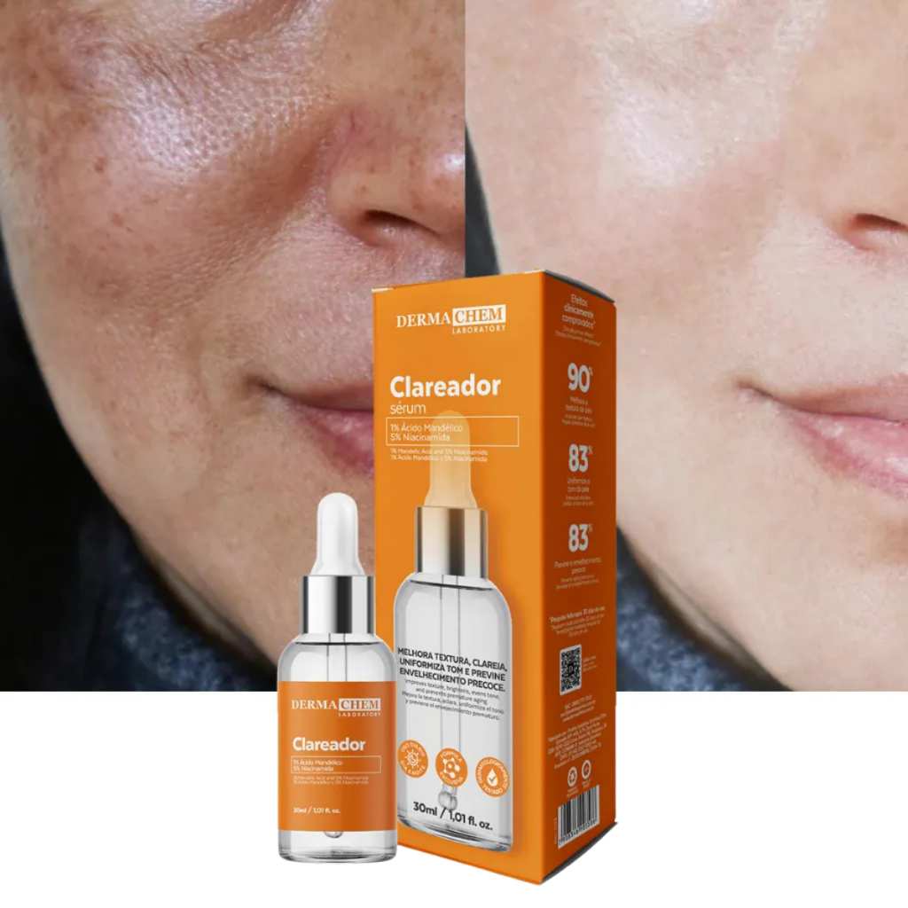 O que é Sérum Antiolheiras Dermachem? Guia e Onde Comprar | BuscaProdutos