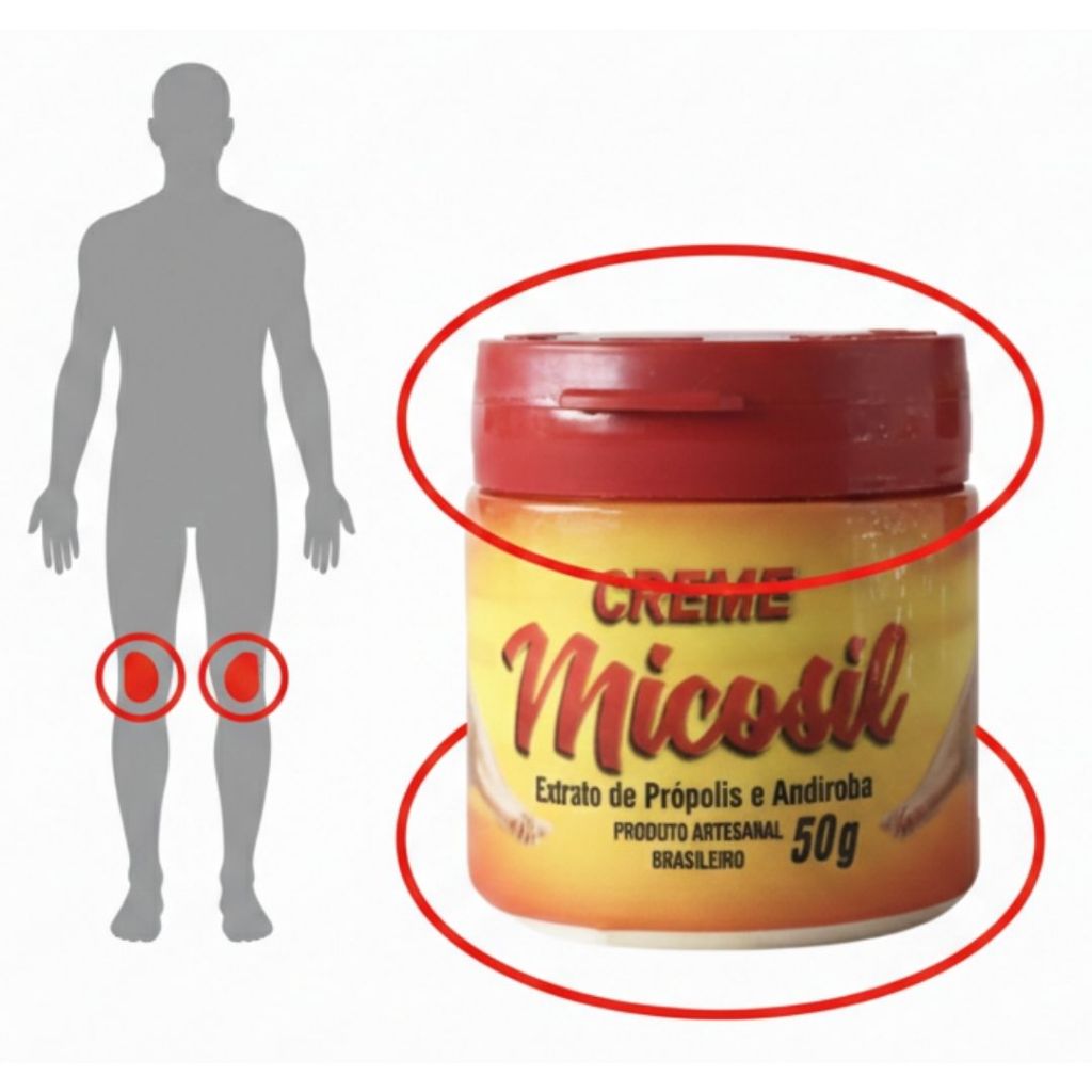 Creme Micozil 50g – Creme Antifúngico Suave para Micoses