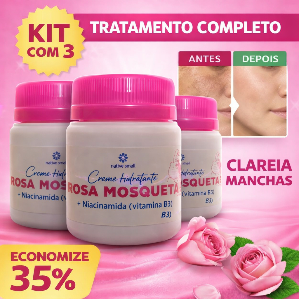 Kit 3 Cremes Rosa Mosqueta com Niacinamida – Clareador, Hidratante e Regenerador da Pele em Oferta na Shopee