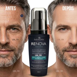 Sérum Facial Renova Ácido Hialurônico 30ml Sofisticatto - Antirrugas Preenchedor  Remove manchas, Rejuvenescimento em Oferta na Shopee