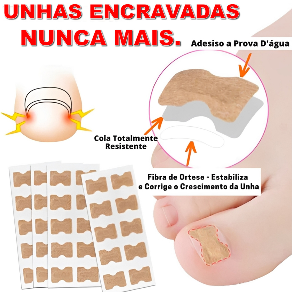 Kit 20/10/5 Adesivo Para Unhas Encravadas Correção de Unha Manicure
