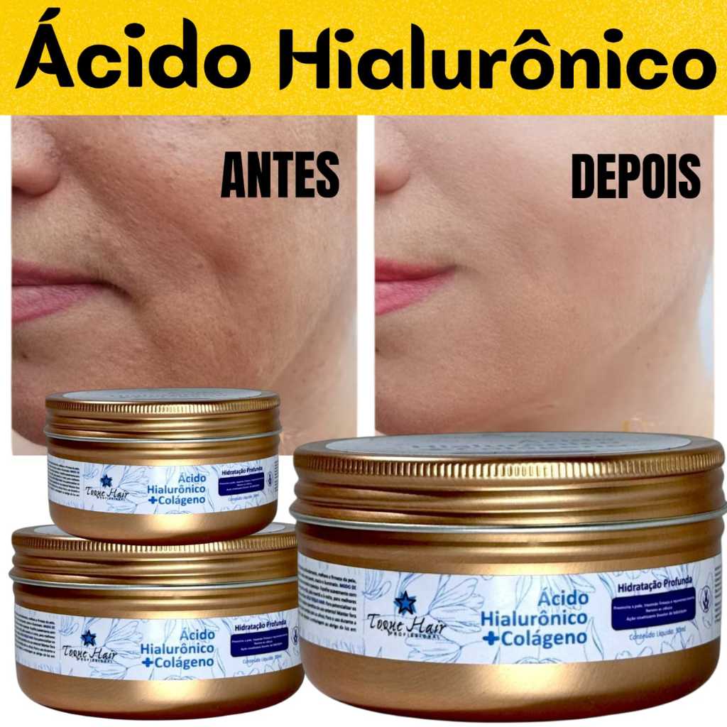 Creme Para O Rosto  Ácido Hialurônico + Colágeno – Hidratação Profunda e Pele Renovada! em Oferta na Shopee