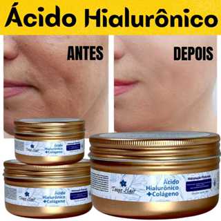 Creme Para O Rosto  Ácido Hialurônico + Colágeno – Hidratação Profunda e Pele Renovada! em Oferta na Shopee