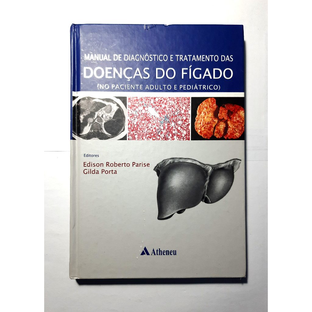 Livro - Manual de Diagnóstico e Tratamento das Doenças do Fígado (Edison Parise) - Capa Dura!