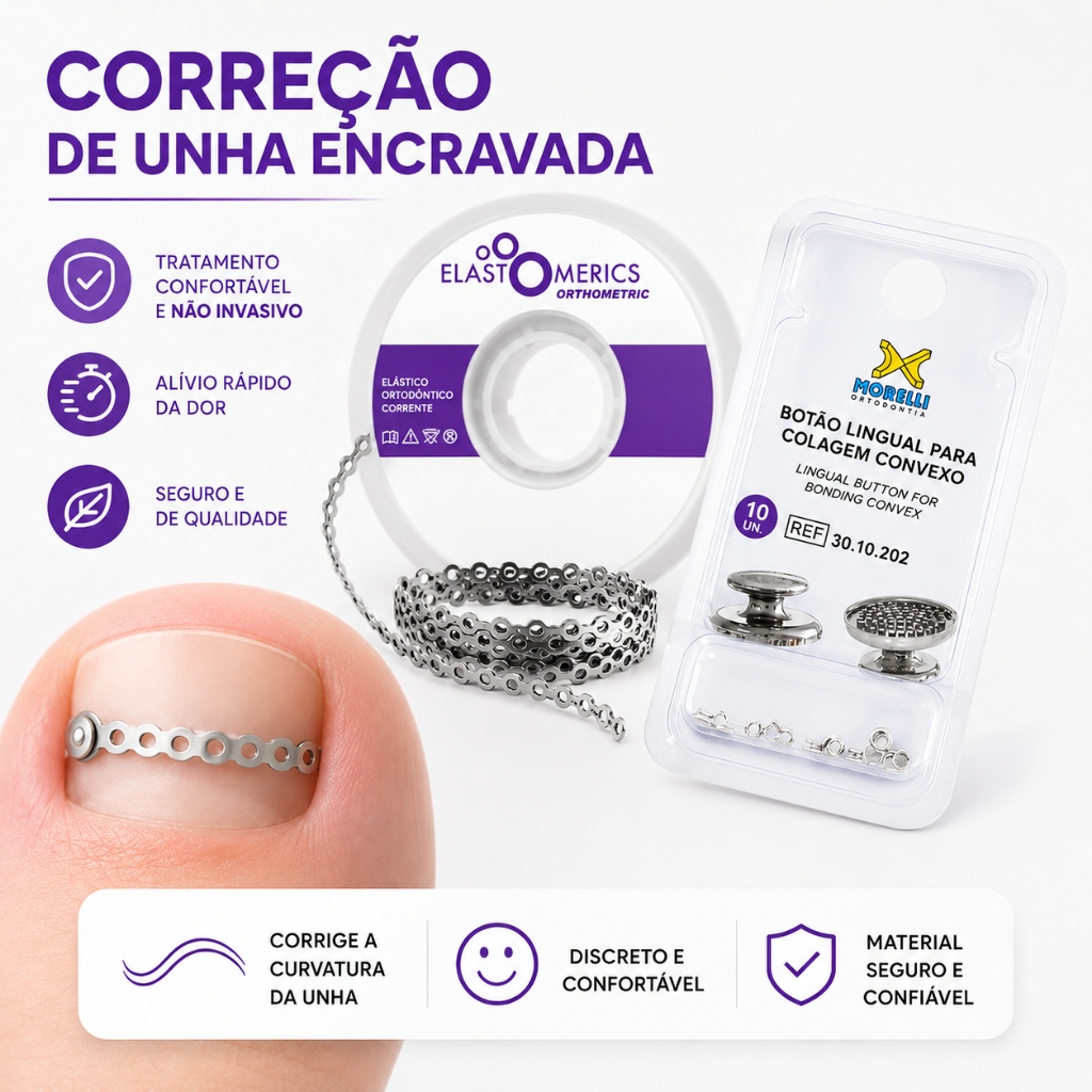 Kit Podologia Com 10 Botão Metal + Elástico Corrente 30CM -  Correção Unha Encravada  FAÇA EM CASA