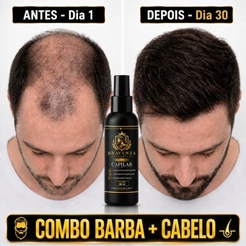 Bravenza Essence Tônico Capilar Cresce Cabelo Barba Bigode Cavanhaque Preenche Falhas Unissex 9