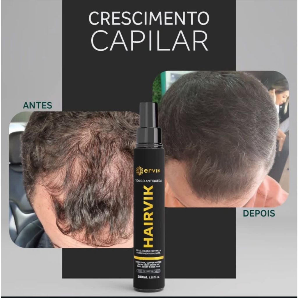 Tônico Capilar Hairvik 100ml Crescimento Acelerado Spray Contra Redução Capilar — imagem 2 de 2
