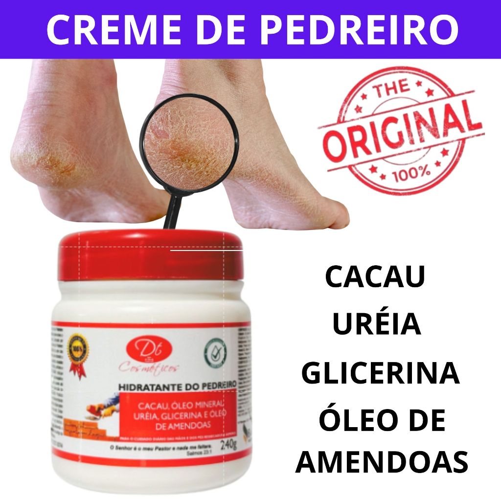 Creme De Uréia Do Pedreiro Cotovelos Mãos Pés Ressecados 30g 55g 120g 240g 500g