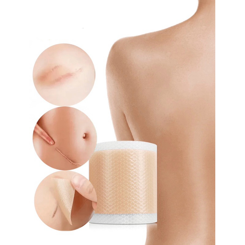 Fita de Silicone Para Cicatriz/Queloide 2.5cm x 1.5 metros Vital Derme