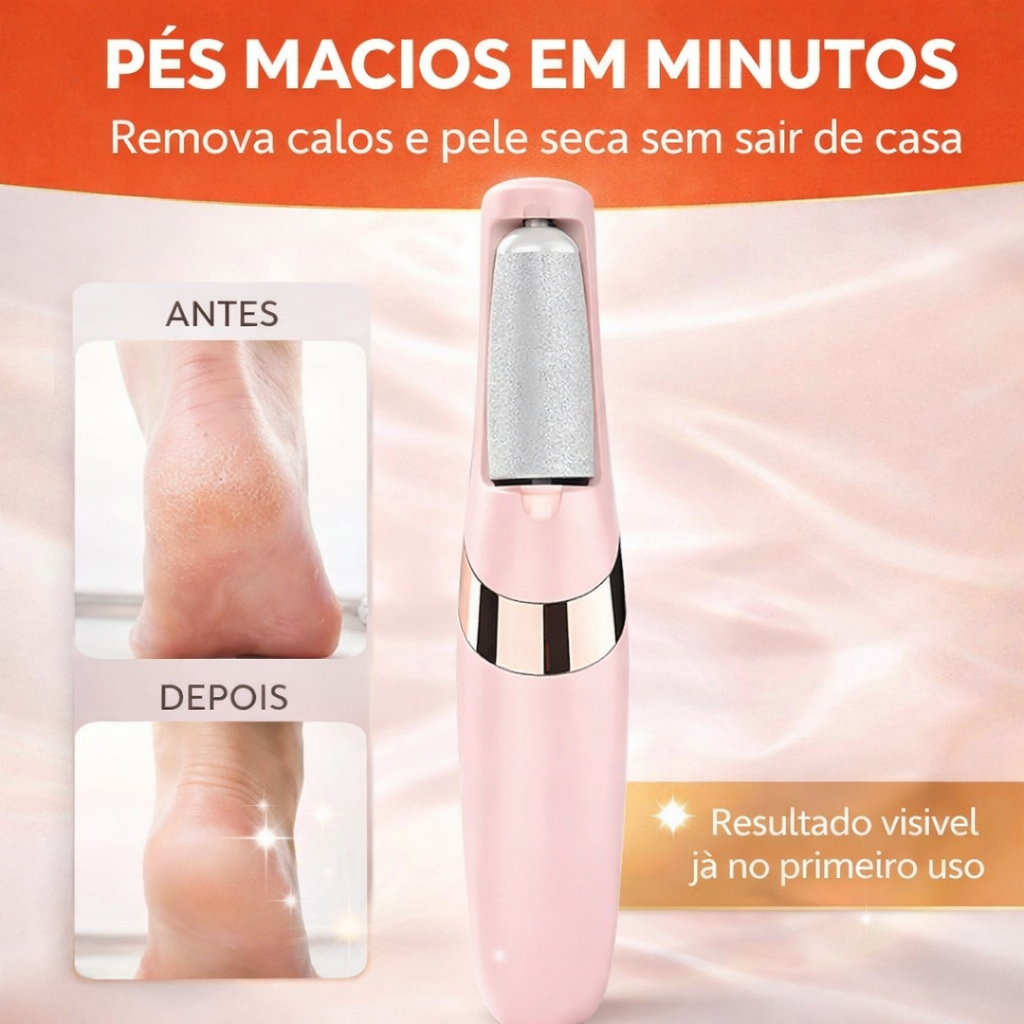 Lixa de Pé Elétrica Recarregável Removedor de Calos Pedicure Profissional à Prova D'Água USB Bivolt MQ7312