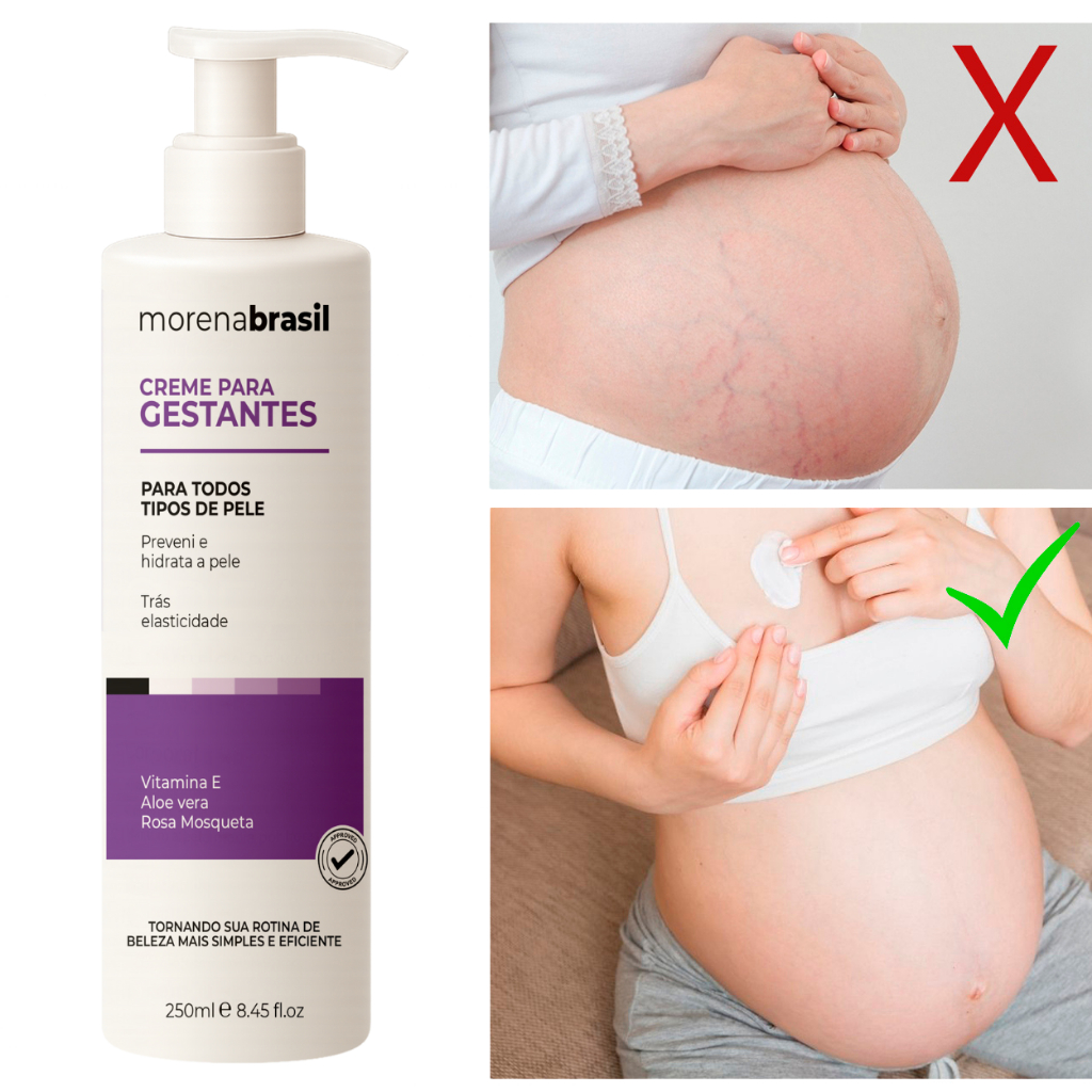 🤰 Creme Prevenção Morena Brasil💆‍♀️-  Firmeza e Prevenção de Estrias 🧡