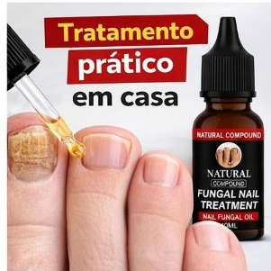 Tratamento para Micose de Unha Antifúngico Óleo Fungicida Remove Fungos Unha Amarelada Forte e Grossa 10ml preta