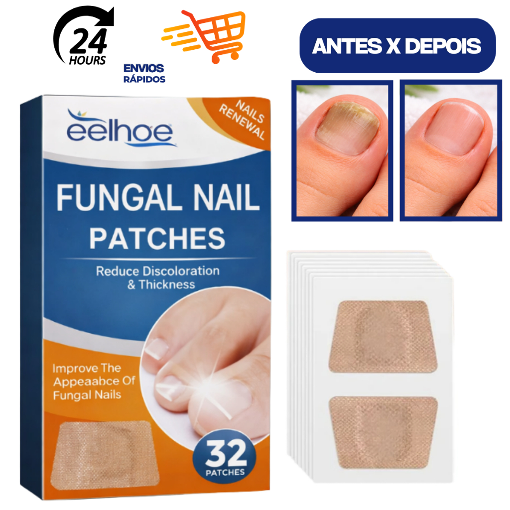Kit Adesivo Reparador de Unhas dos Pés Fungo Unha 32/64 pcs