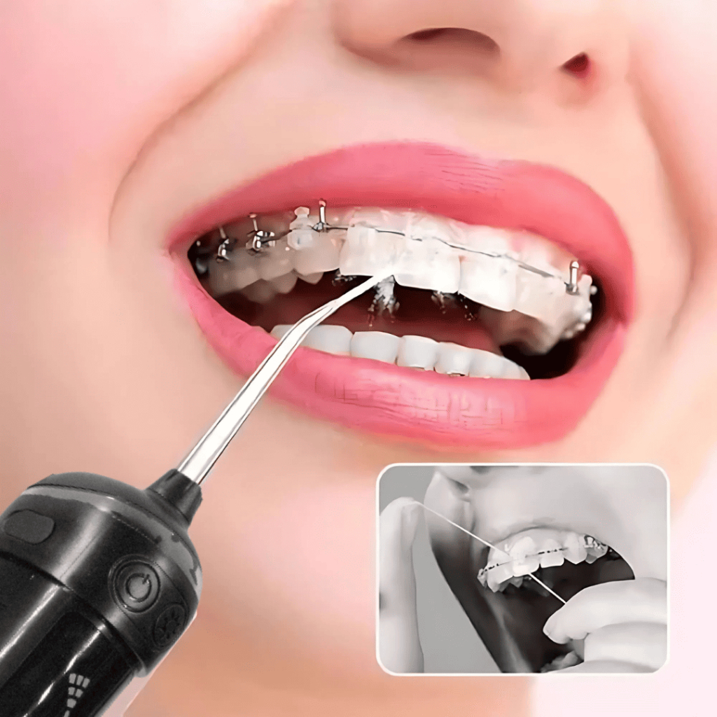 Irrigador Bucal Portátil 8 Bicos 6 Modos Até 130 PSI Limpeza Dental Aparelho Gengiva Higiene Diária CHEF D