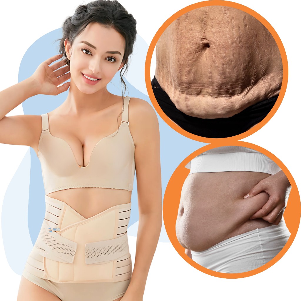Cinta Abdominal Ajustável Flacidez Diástase Pós-Parto e Inchaço