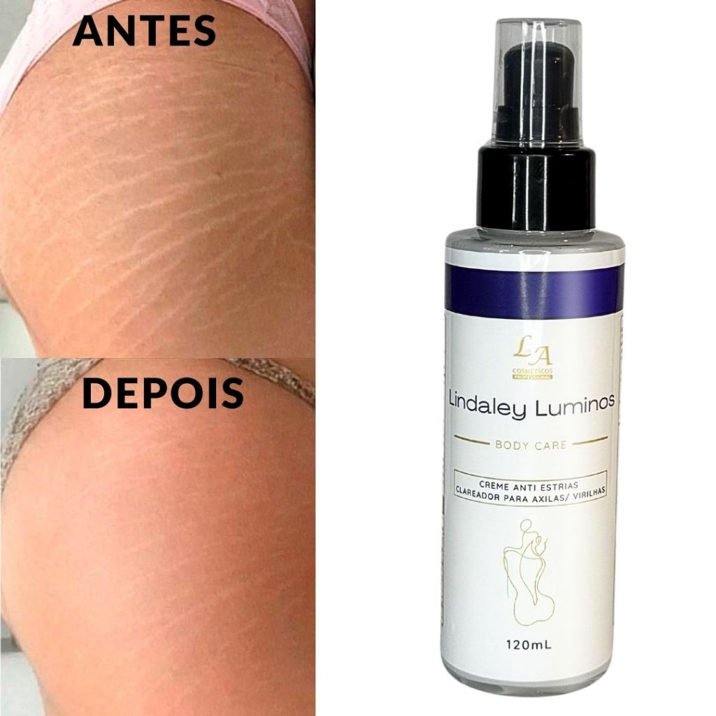 Lindaley Luminos - Anti Estrias - Clareador de Axila, Virilha, Joelhos 120ml - Entrega rápida