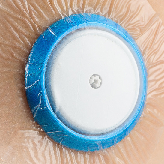 Protetor para Sensor de Glicose Freestyle Libre 1 e 2 Conforto e Segurança no seu Dia