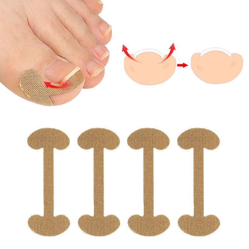 Kit 4/8/12/16 Adesivos Desencrava Unha Encravada Órtese Corretora Podologia Pedicure Tratamento