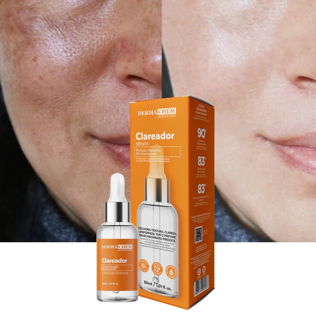 Sérum Facial Clareador Dermachem de Melasma Uniformiza o tom da Pele Clareia Manchas Clareador Niacinamida