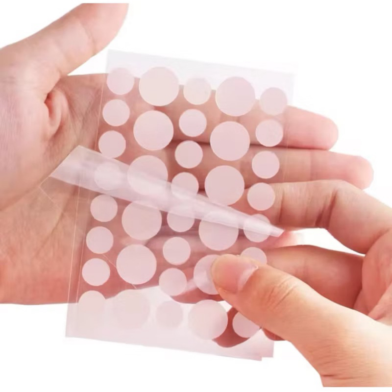 Kit com 36 Adesivos Hidrocoloide Anti Acne Patch Secativo Espinha Invisível em Oferta na Shopee