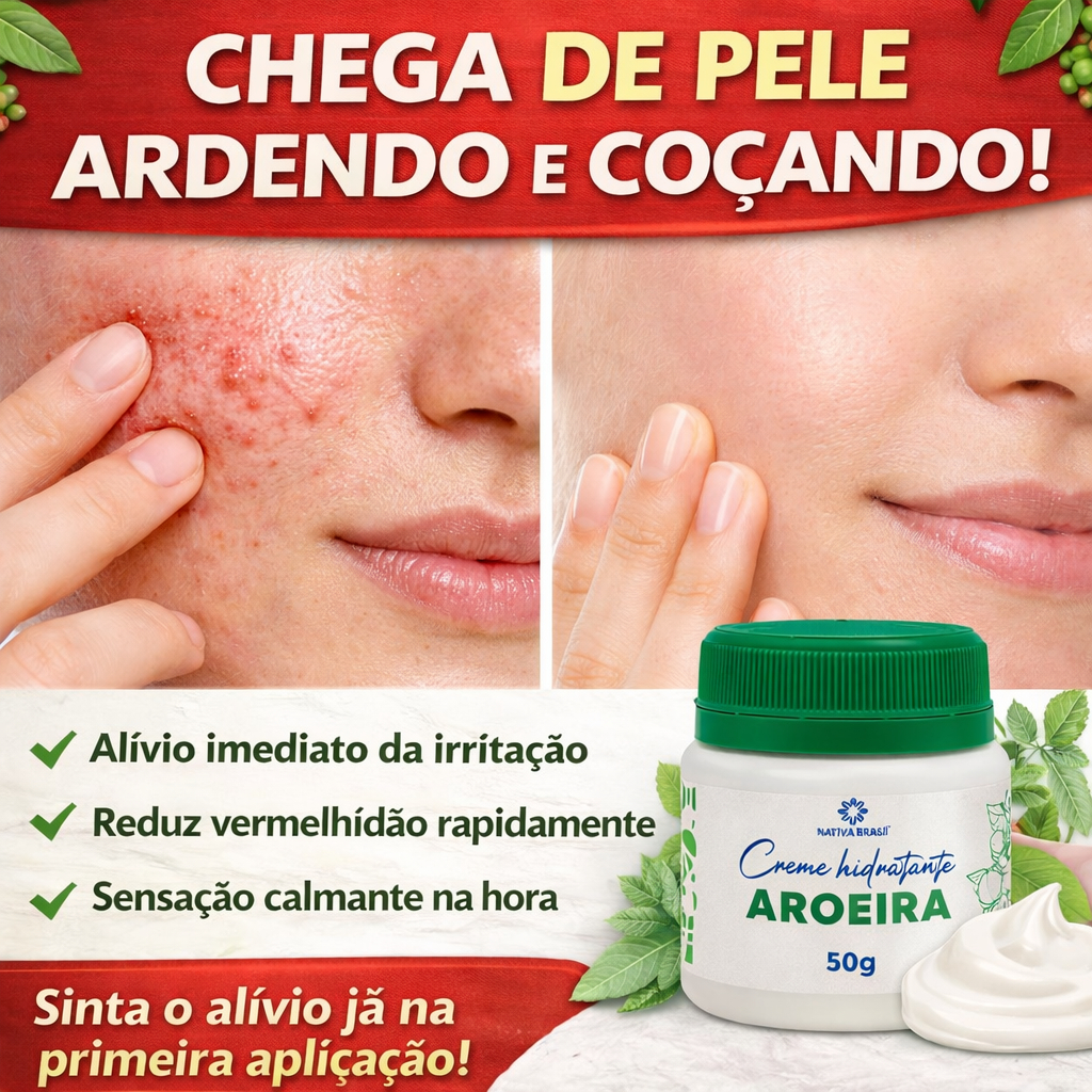 Creme de Aroeira 50g Hidratante Calmante | Ajuda na Irritação da Pele, Vermelhidão, Acne e Pós Depilação