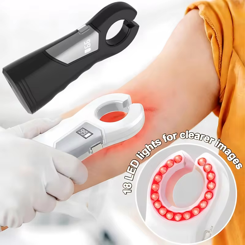 Localizador de Veias Recarregável, Luz Ajustável para Flebotomia e Acesso IV, Compatível com Todos os Tipos de Pele