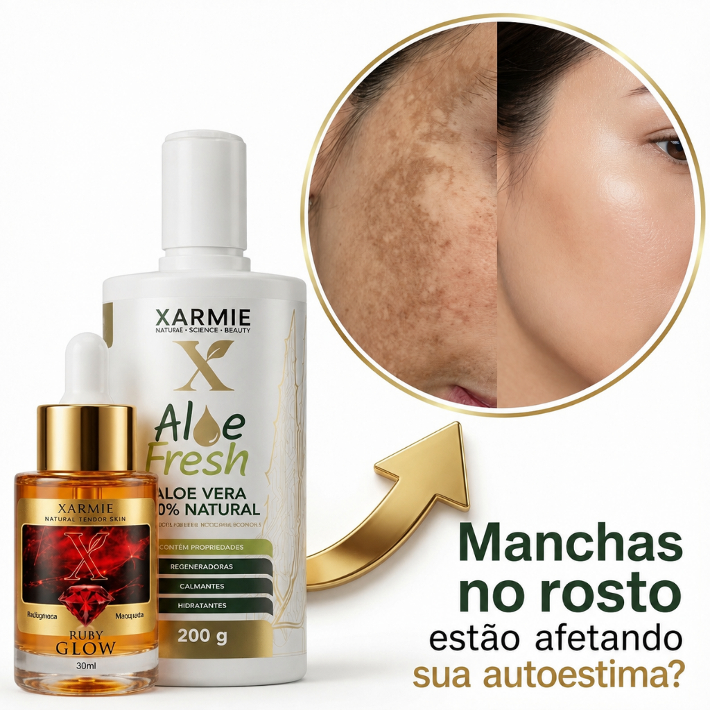 Kit Melasma Ruby Glow 30ml + Aloe Fresh 200ml Clareador Facial Hidratação Pele e Manchas Escuras
