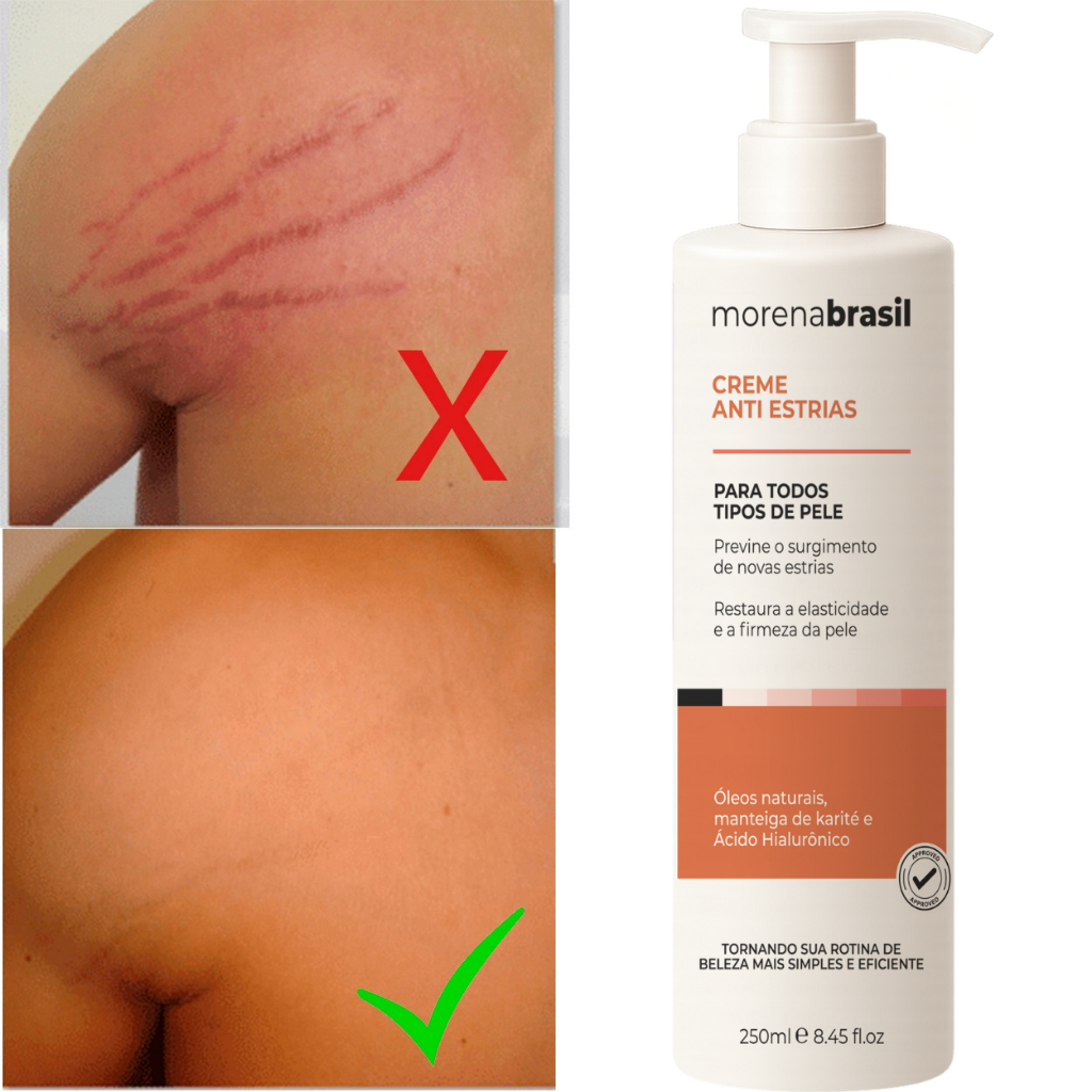Creme Anti-Estrias Morena Brasil - Ação Poderosa com Colágeno e Elastina