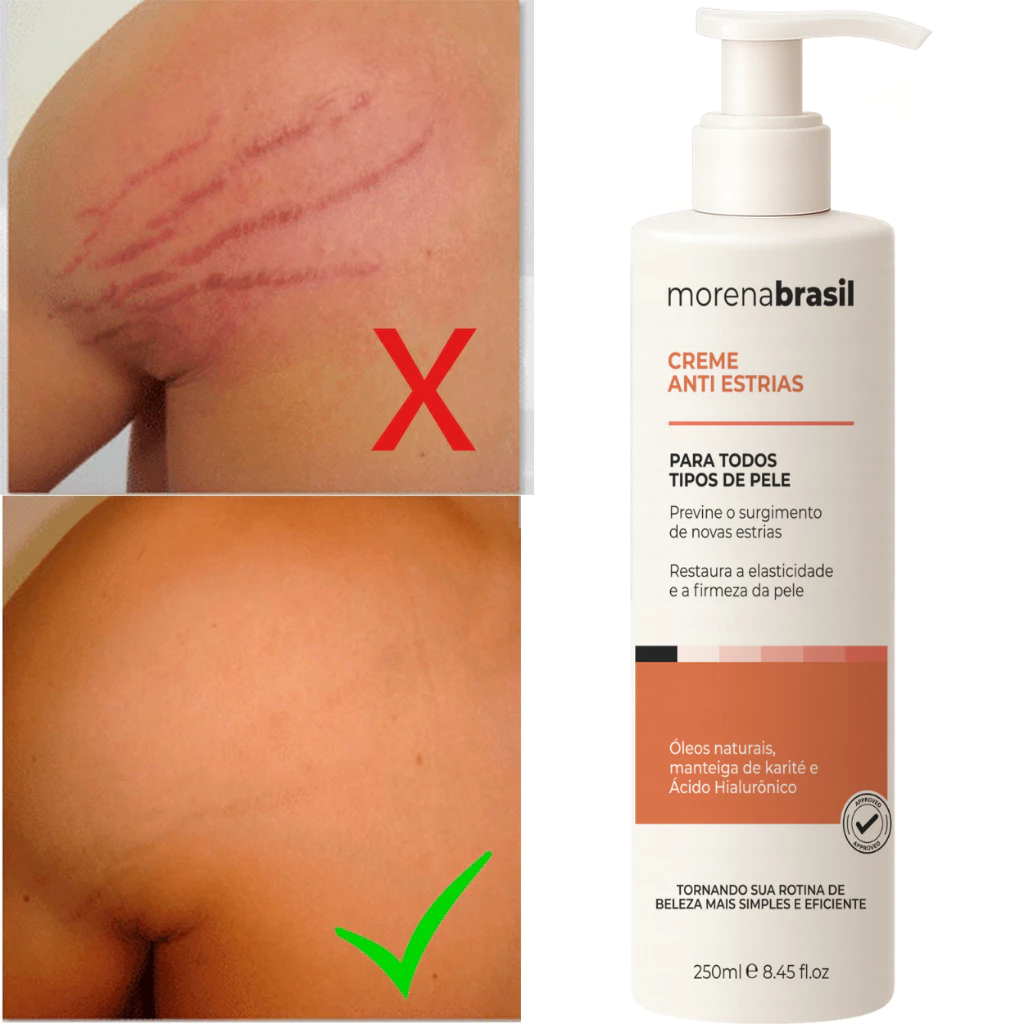 Creme Anti-Estrias Morena Brasil - Ação Poderosa com Colágeno e Elastina — imagem 1