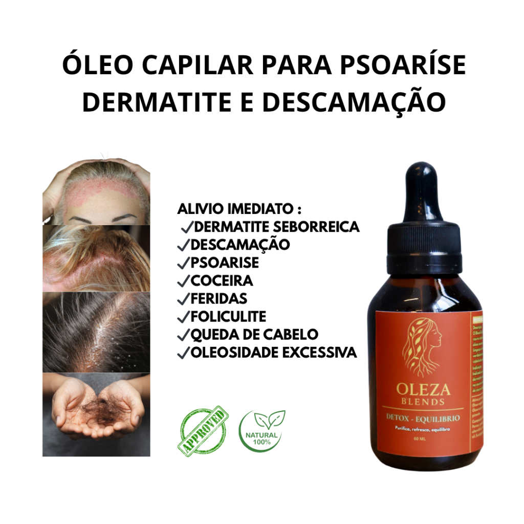 Blend de Óleos Capilar Alívio da Dermatite Seborreica Caspa Coceira Oleosidade Psoríase Feridas Dor no Couro Cabeludo