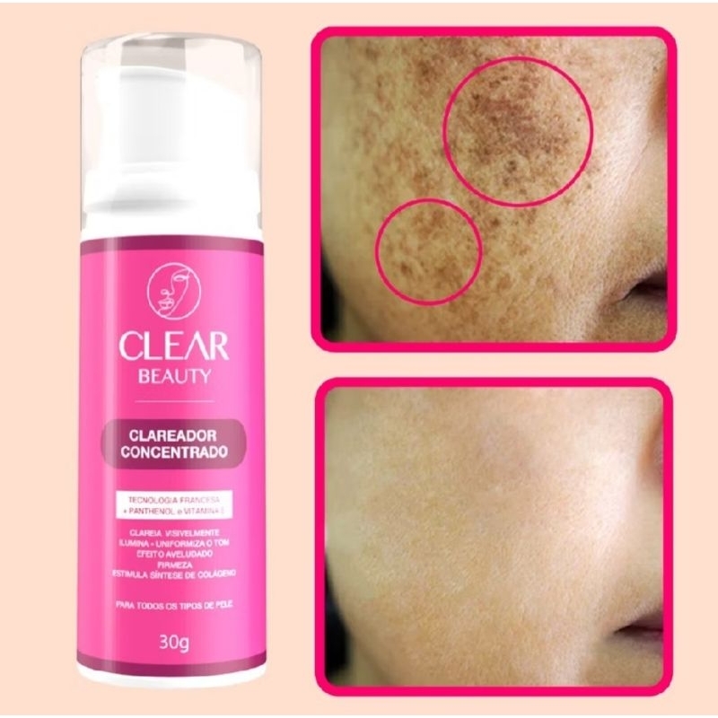 Clareador Intimo Manchas Virilha Axila e Partes Intimas - Clear Beauty