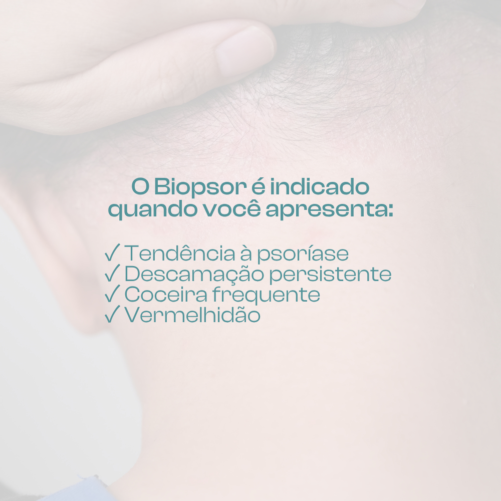 BIOPSOR SHAMPOO CALMANTE PARA PSORÍASE - 200 ML - Biozenthi — imagem 2 de 2