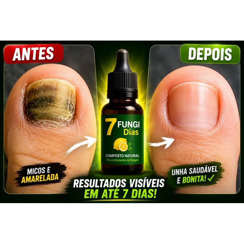 TRATAMENTO PARA MICOSE DE UNHA rápido 10ml verde