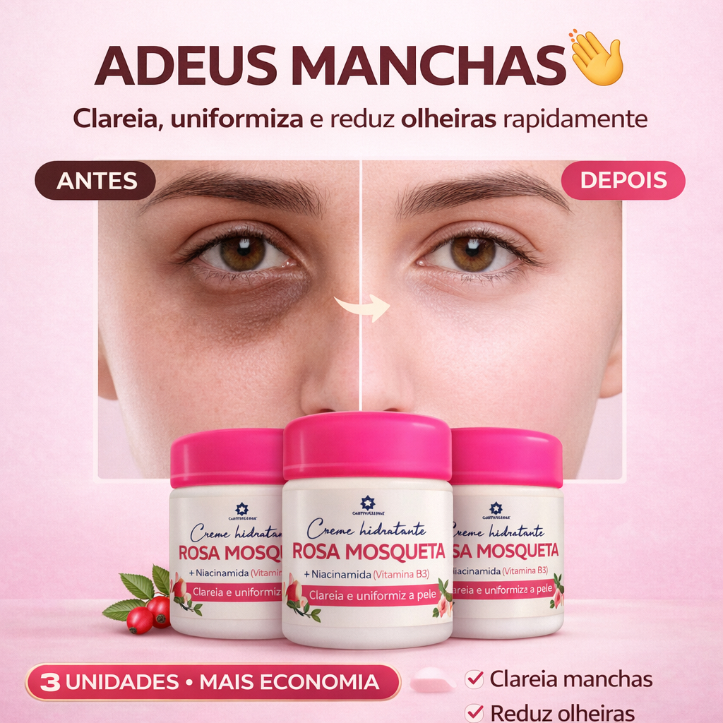 Kit 3 Cremes Rosa Mosqueta com Niacinamida – Clareador, Hidratante e Regenerador da Pele
