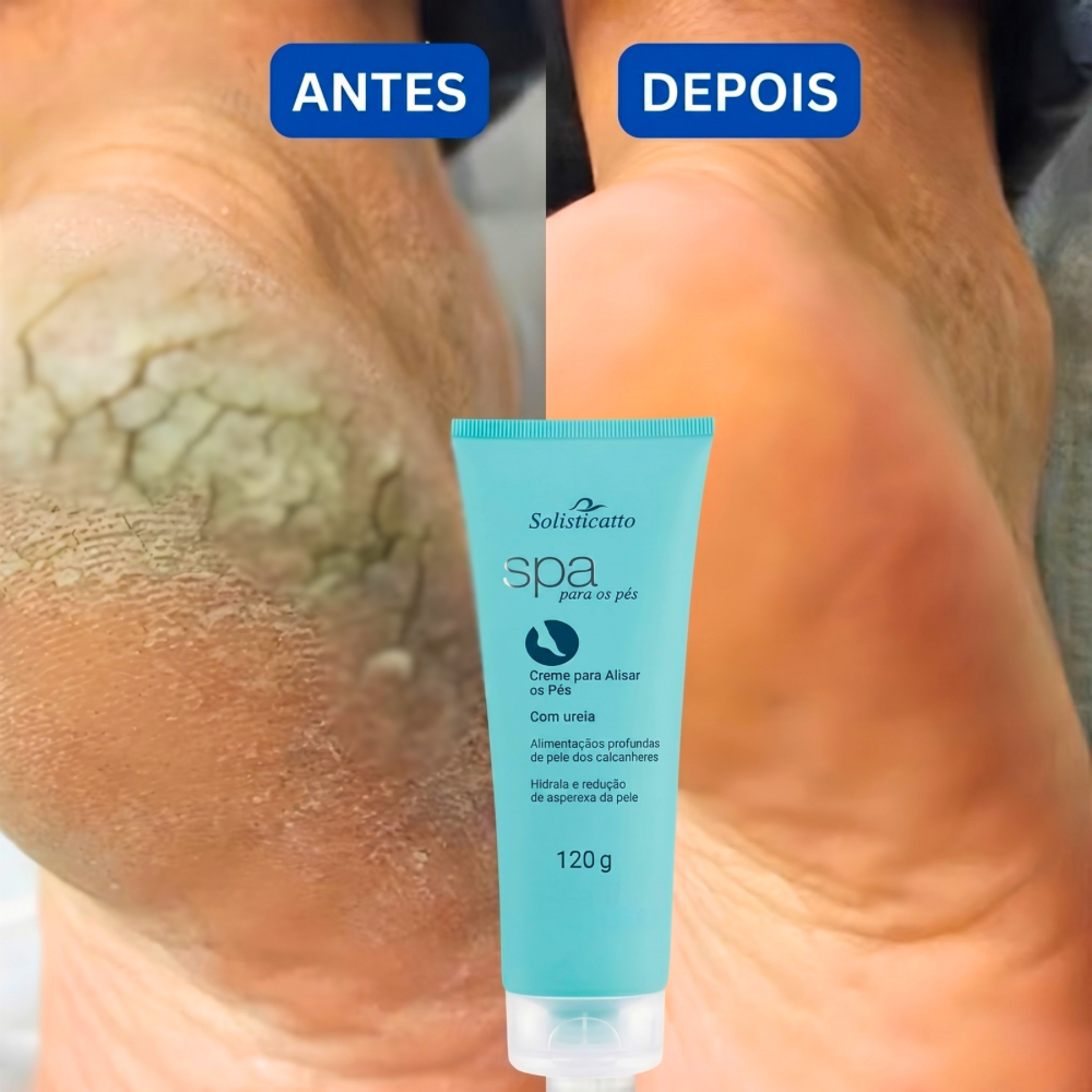 Creme para Pés Rachados com Ureia 10%