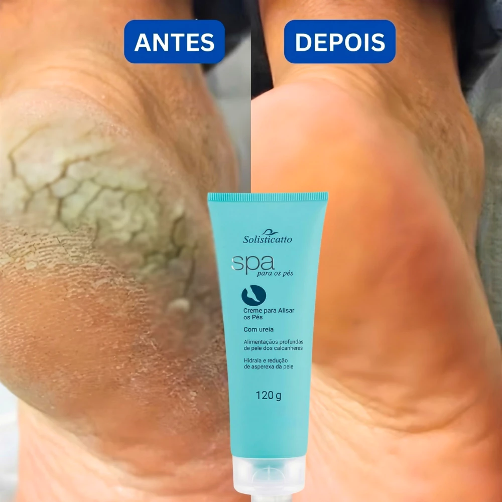 Creme para Pés Rachados Ressecados e Fissurados Spa dos Pés Ureia 10% Hidratação Profunda Calcanhar — imagem 1