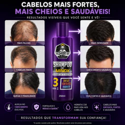 Shampoo com Minox para Cabelos Fracos Antiqueda Crescimento e Hidratação 250ml