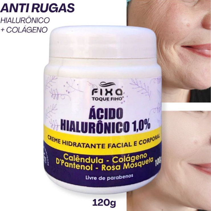 Creme Facial e Corporal Acido Hialuronico Colágeno E Rosa Mosqueta100G Anti Rugas Hidratante E Rejuvenescedor