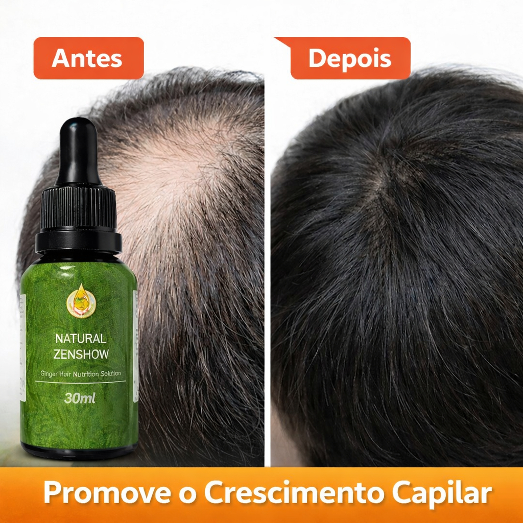 Óleo Essencial ZenShow Para Crescimento de Cabelos Capilar Tração Louco Gengibre Selvagem Prevenir Alopecia 30ml em Oferta na Shopee
