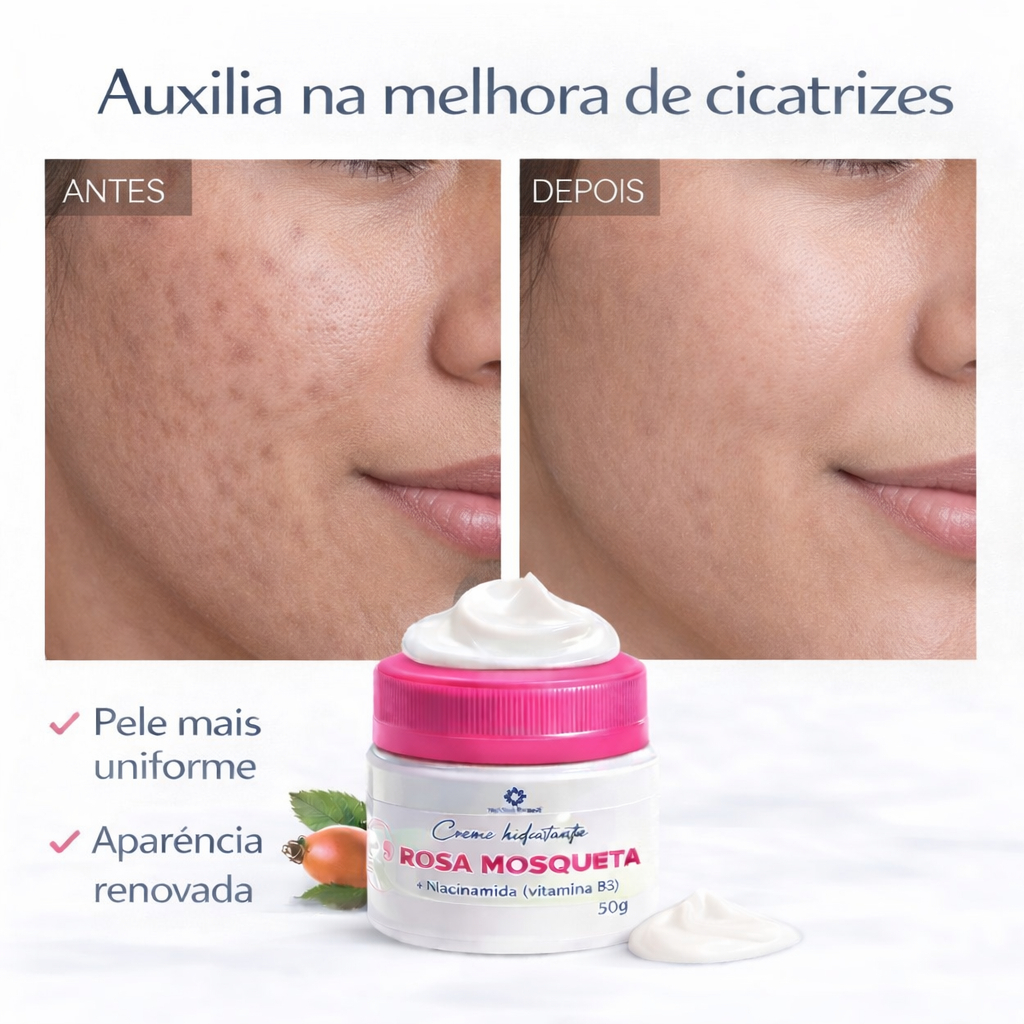Creme Rosa Mosqueta com vitamina b3 ajuda suavizar cicatrizes rugas clareador de manchas